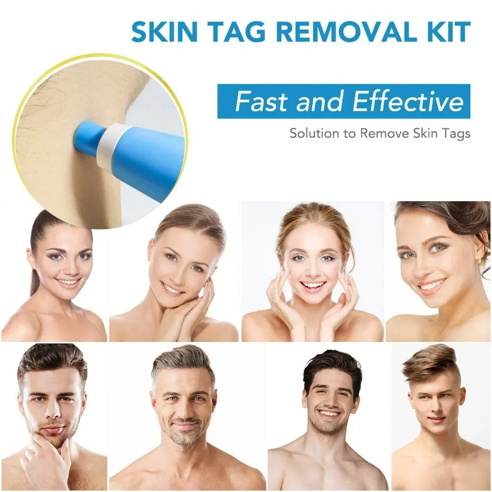 2 In1 Painless Auto Skin Tag Mole Wart Removal Kit