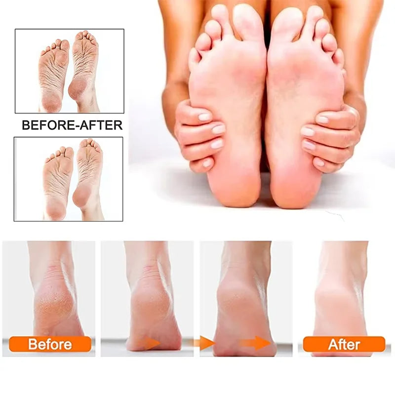 Professional Electric Foot Callus Remover